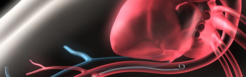 CardioBridge